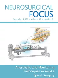 Neurosurgical Focus 51(6)