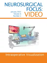 Neurosurgical Focus: Video 6(1)