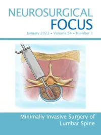 Neurosurgical Focus 54(1)