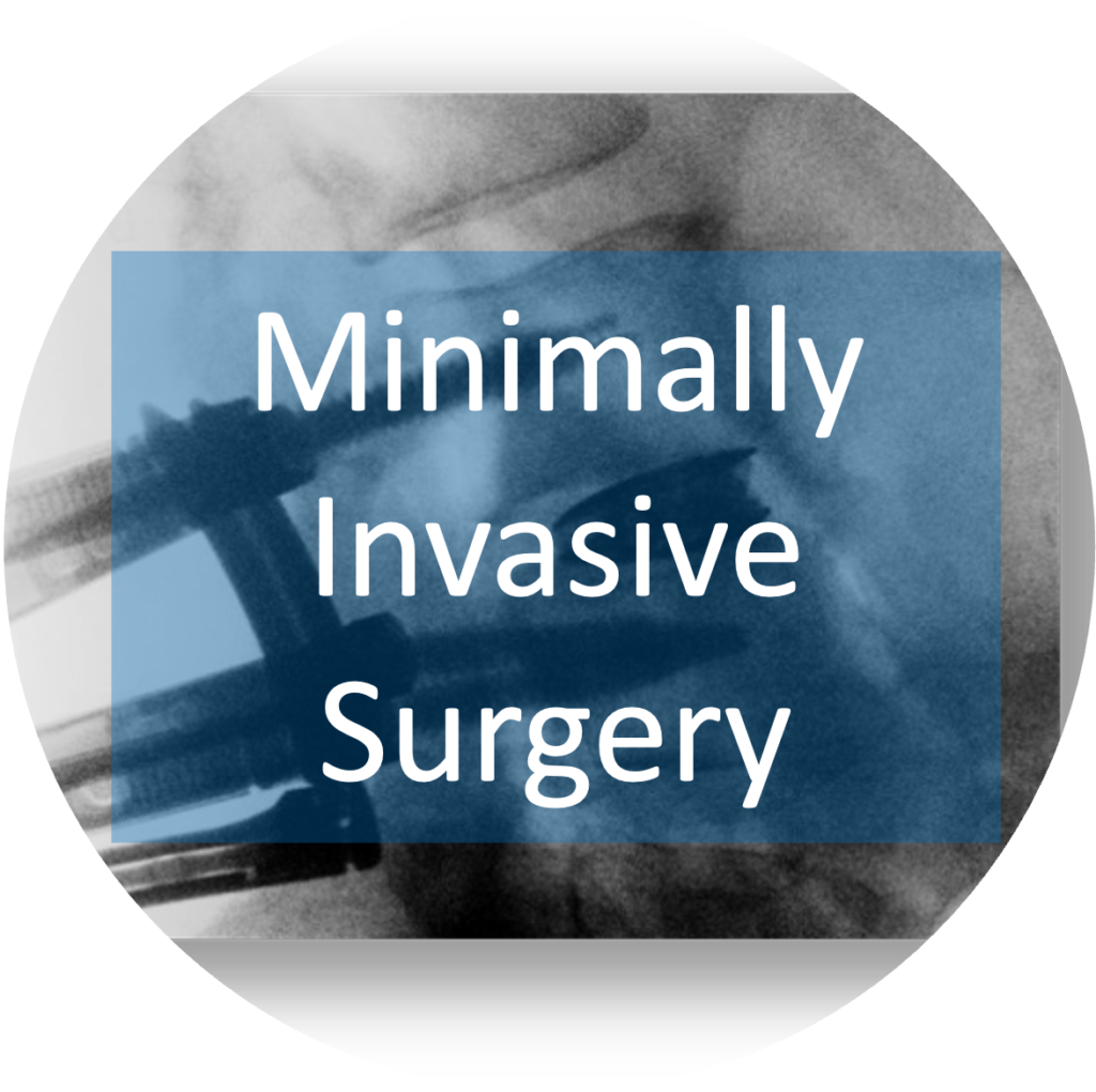 Minimally Invasive Surgery