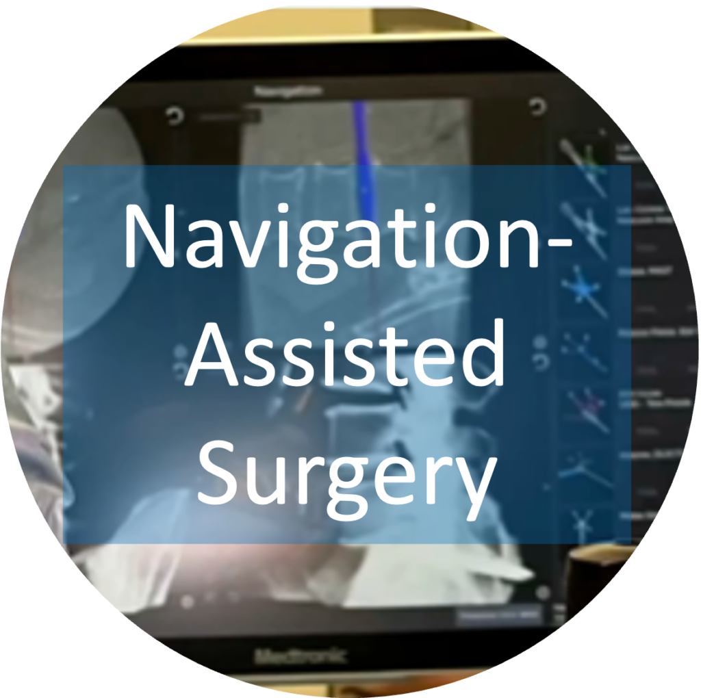 Navigation-Assisted Surgery