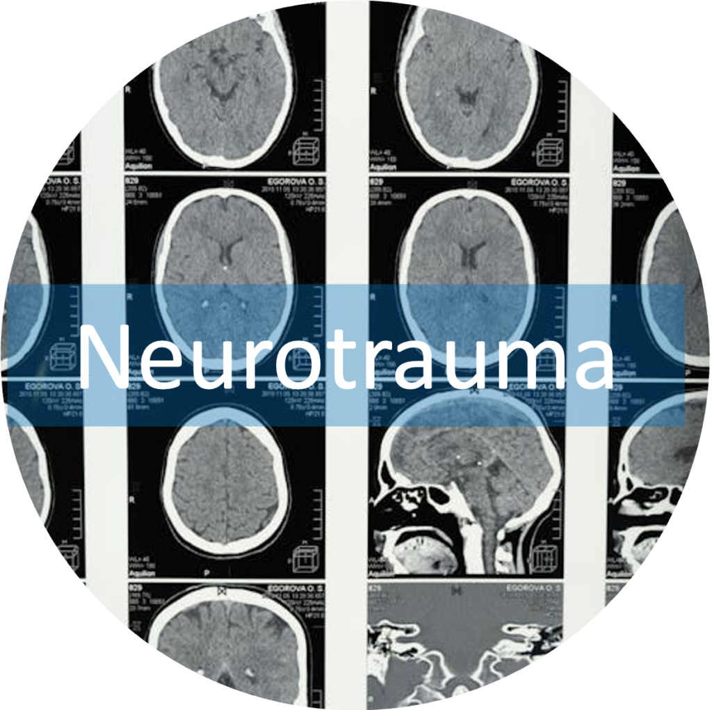 Neurotrauma